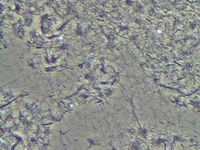 トレポネーマデンティコーラ