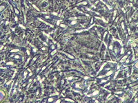 カンジダアルビカンス